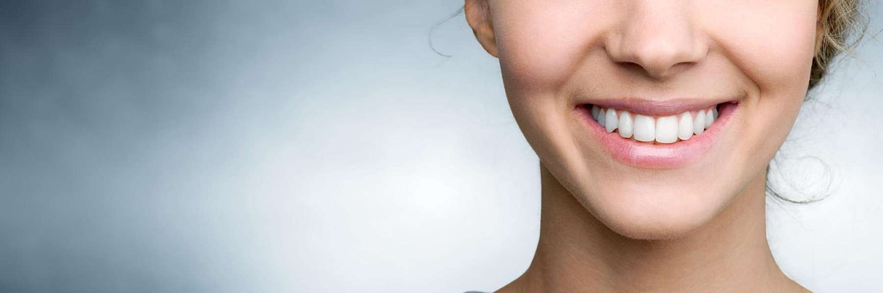 what to expect during full mouth reconstruction